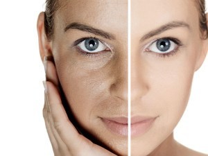 21-1432191651-1-wrinkles-300x225