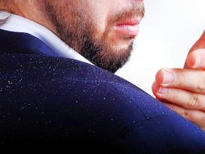 how-to-get-rid-of-dandruff-1